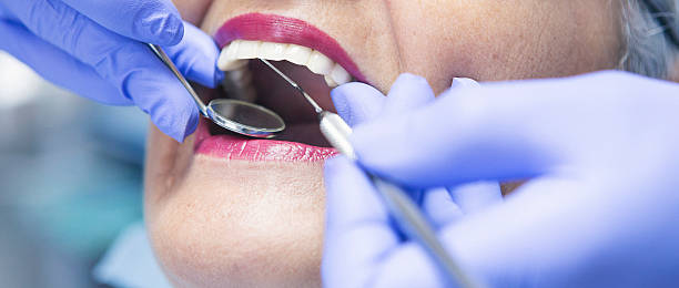 Best Emergency Tooth Extraction in Ceresco, NE